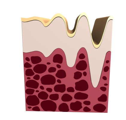 Hydrolyzed collagen safety review
