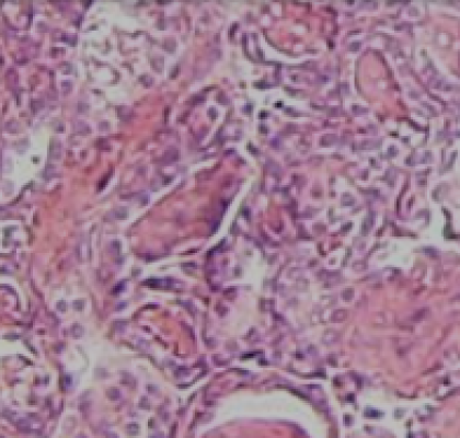 Vitamin K2 and bone turnover